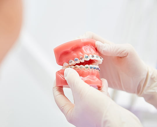 ワイヤー矯正がついた葉の模型の写真